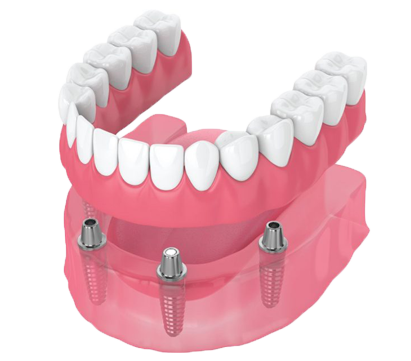 best root canal treatment in india